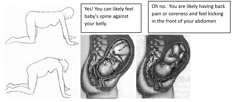 prenatal exercise